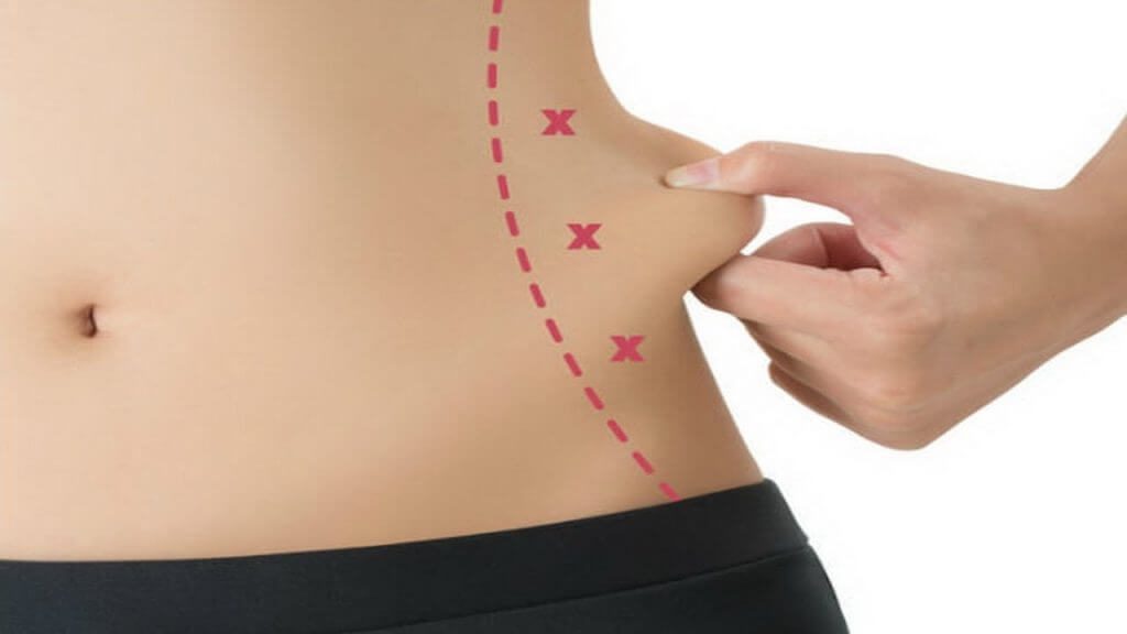 λιποδιάλυση aqualyx πλαστικοί χειρουργοί